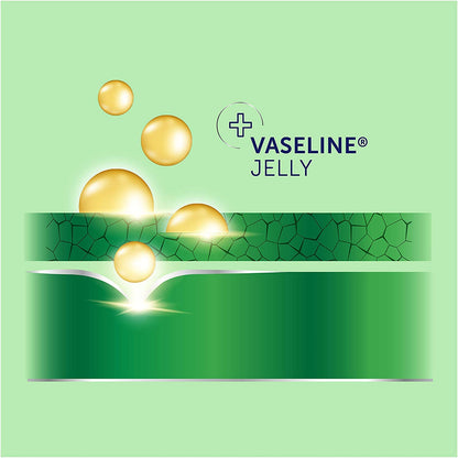 Vaseline Total Moisture Body Lotion Aloe Fresh - 10 Oz ( Pack Of 3)