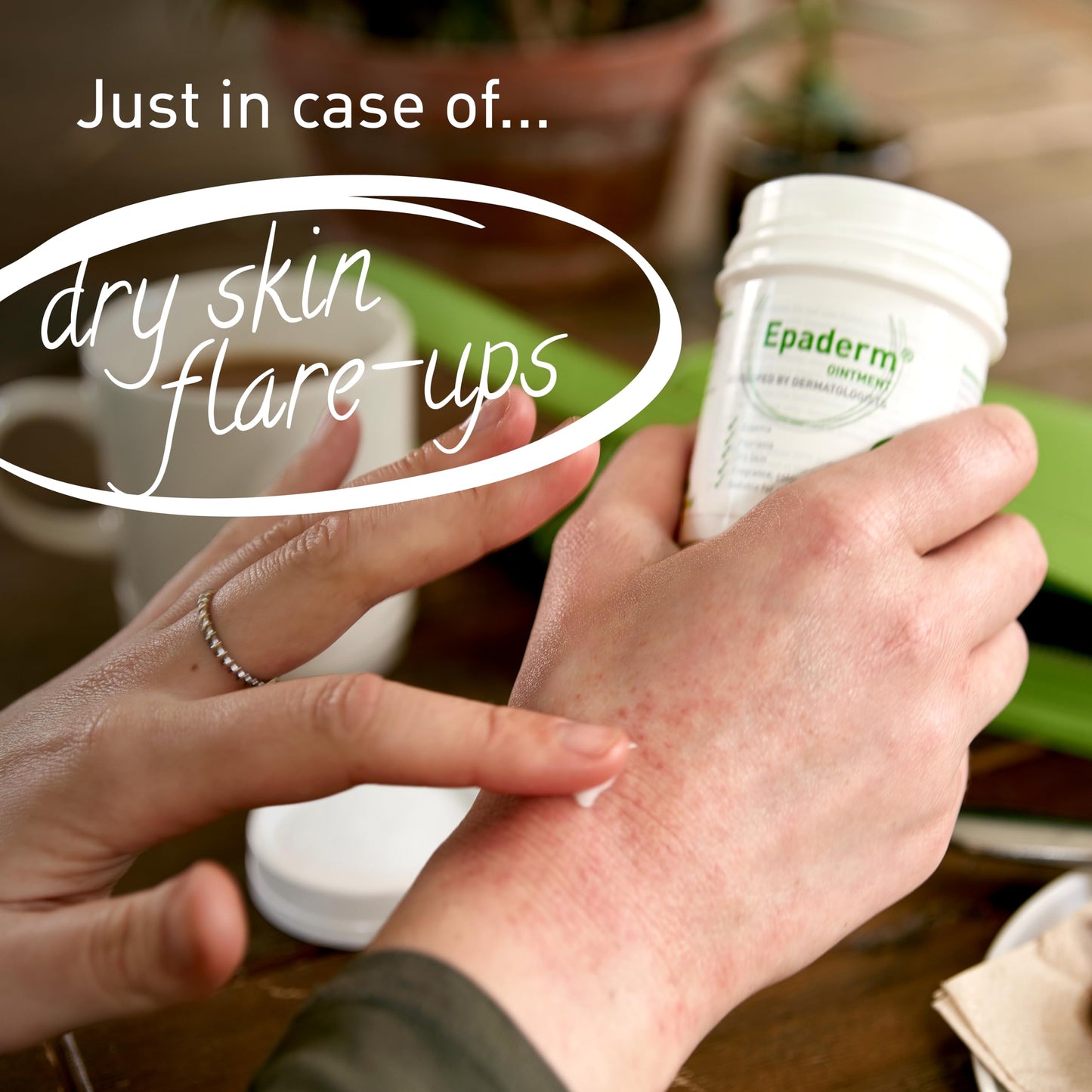 Epaderm Ointment
