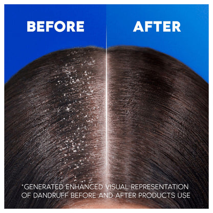 Head & Shoulders Anti Dandruff Shampoo